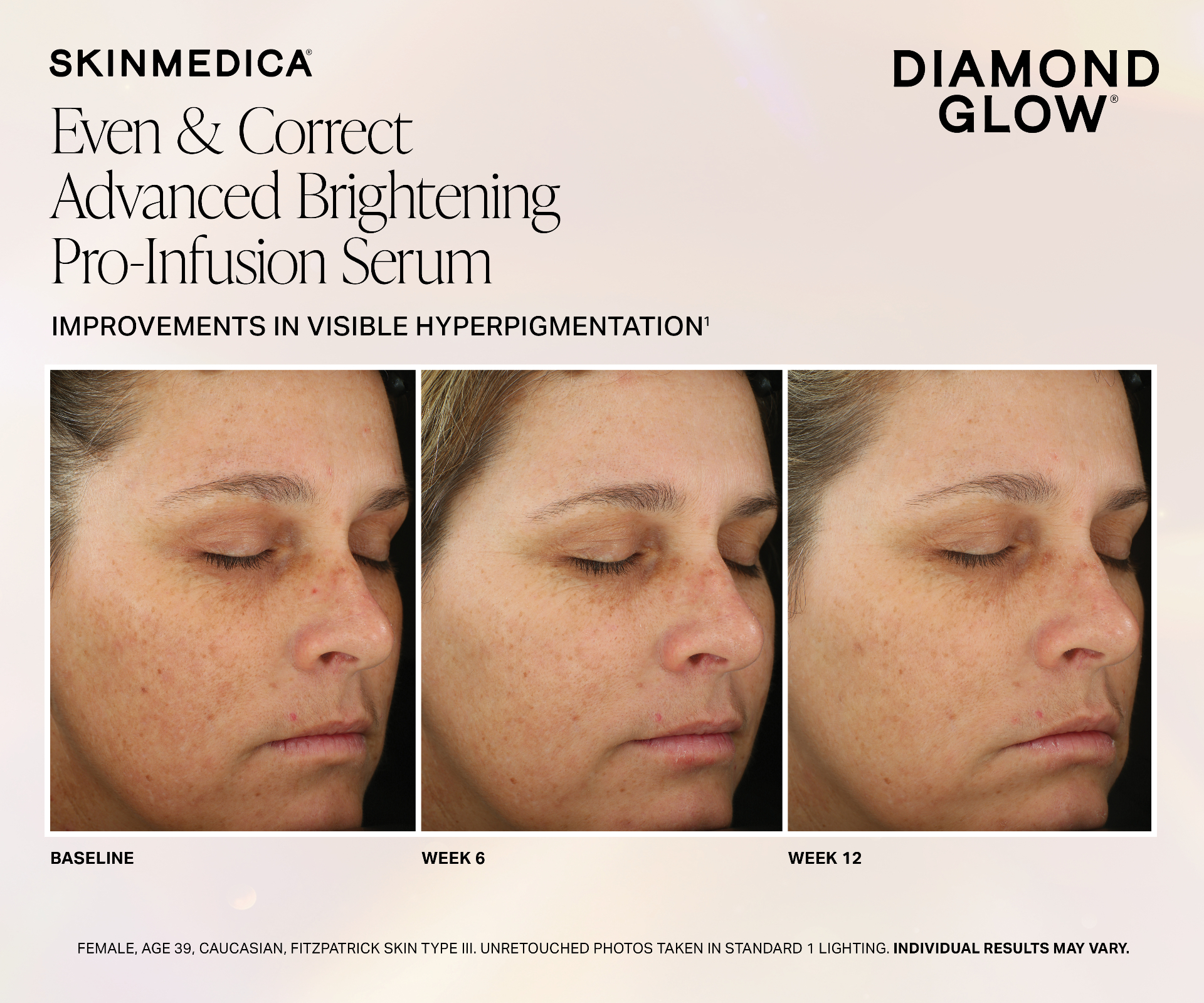 DiamondGlow® Facial: Benefits & Before/After Results — Tru Integrative Wellness blog article