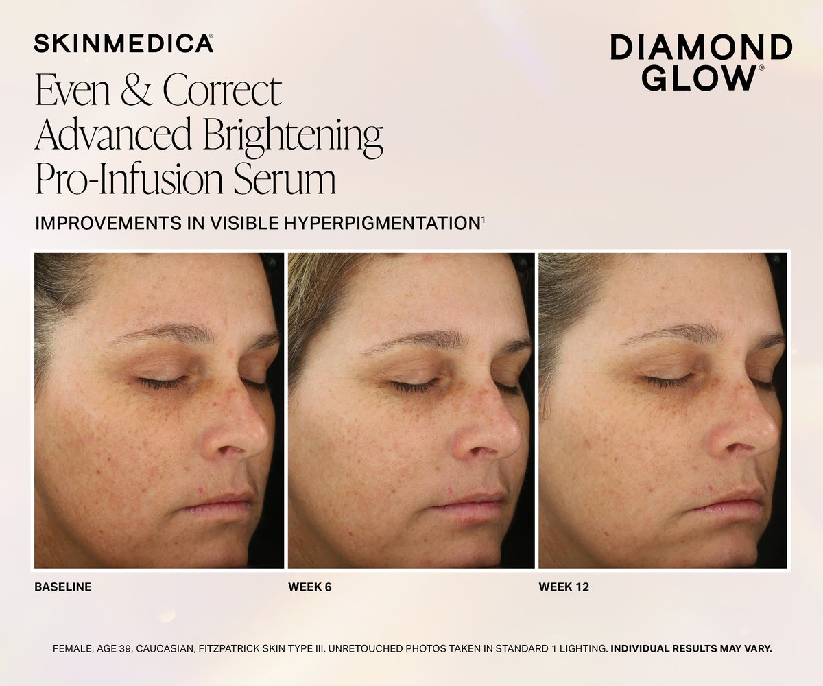 DiamondGlow before and after brightening results